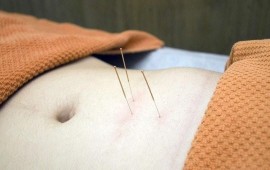 גיא קארו - מטפל בדיקור סיני קרדיט תמונה PIXABAY